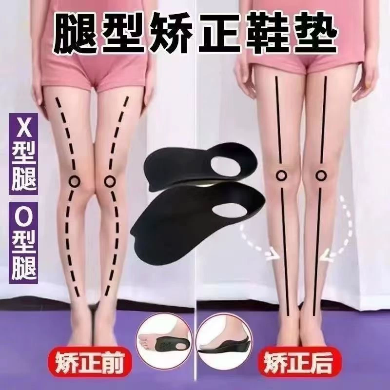 [Один кусок волос] Плоские плоскостопие коррекция стельки xo ножки подошвенные ортопедические внутренние и внешние ортопедические стельки