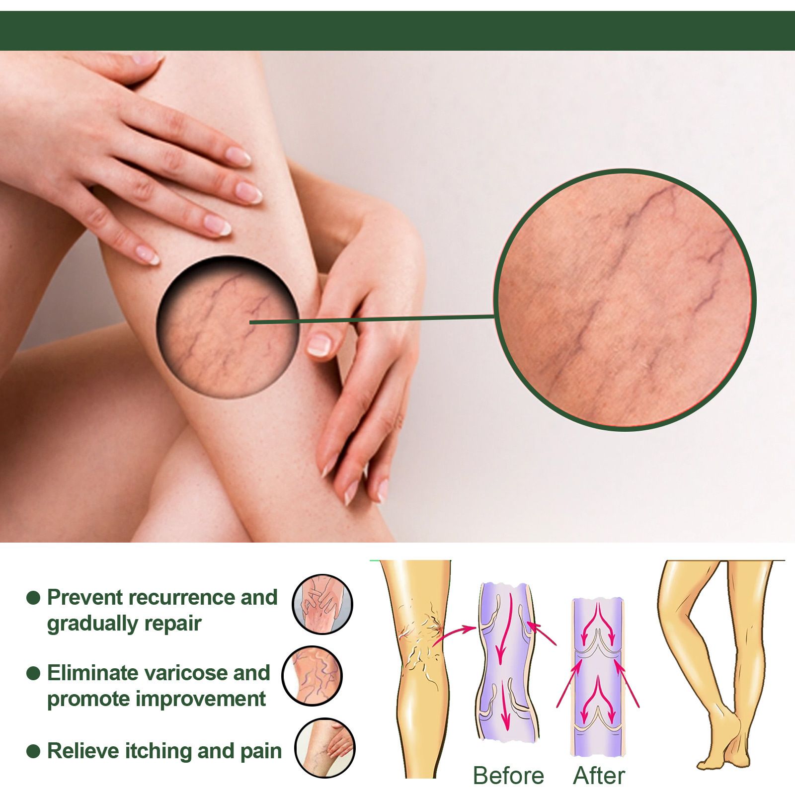 Massaggio endovenoso Eelhoe con sapone per lenire le varici, alleviare le sporgenze nelle gambe dei lombrichi e pulire il polso_voghion.com