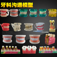 牙齿模型仿真钢牙出口牙齿教学沟通种植修复牙套拆卸现货