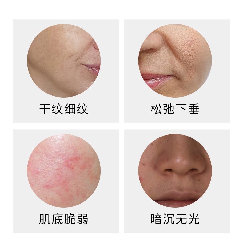 Elite smoothing anti-age antioxidant moisturizing pulls up face mask for skin care, easy application, anti-wrinkle 2