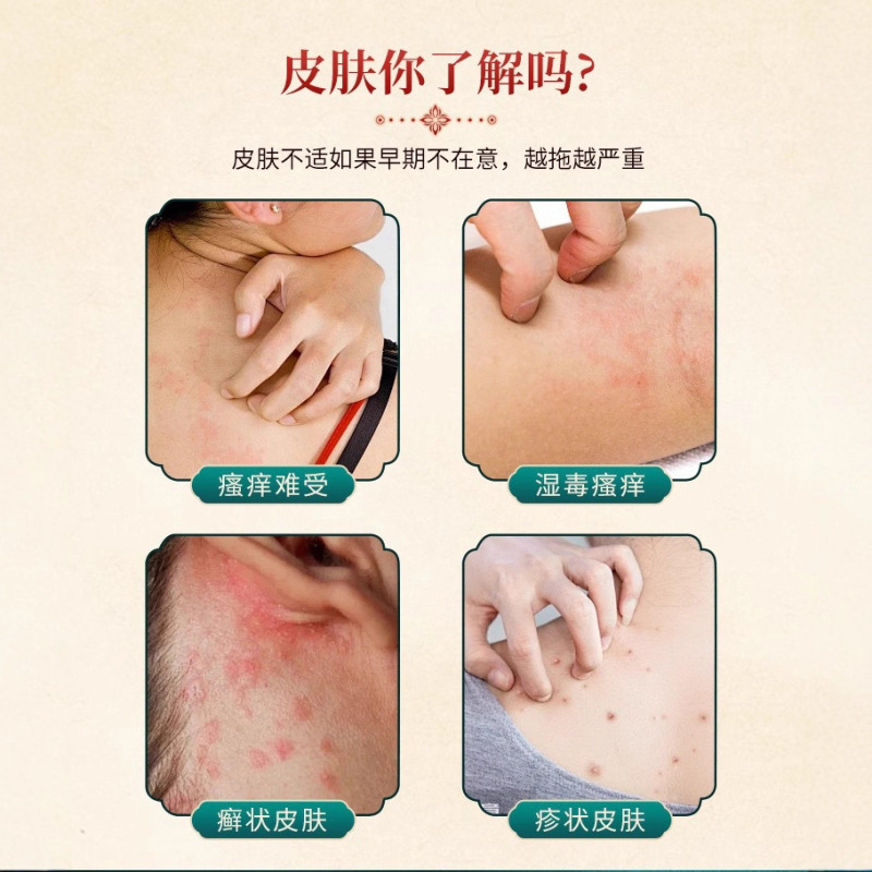 香港薬局雲南マテリアメディカ菌王のかゆみ、足の汗、足の臭い、足の乾燥とかゆみ、全身のかゆみ、外用|undefined