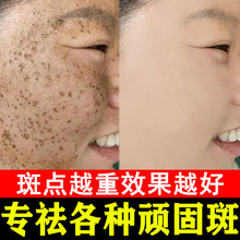 �������˪�ӏ�����ȸ���S�ְ�����߇��y����ȥ��ɫ��ը��˪��˪