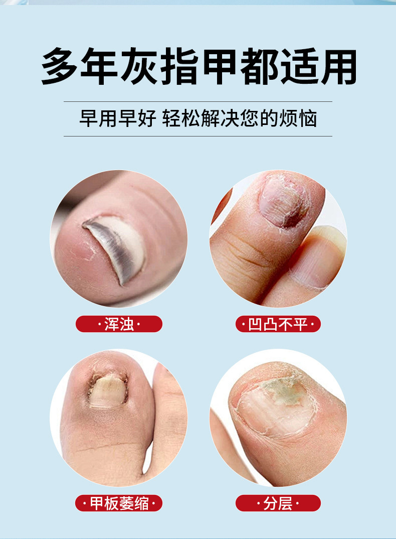 German Nail Fungus Pen, Nail Fungus Antibacterial Gel, Nail Protection and Maintenance All-In-One, No Need to Remove Nails, Nail Repair and Maintenance detail image