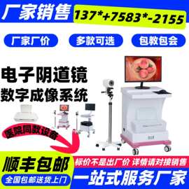 厂家供应-医用设备阴道镜 厂家批发阴道镜 私立诊所数码电子阴道