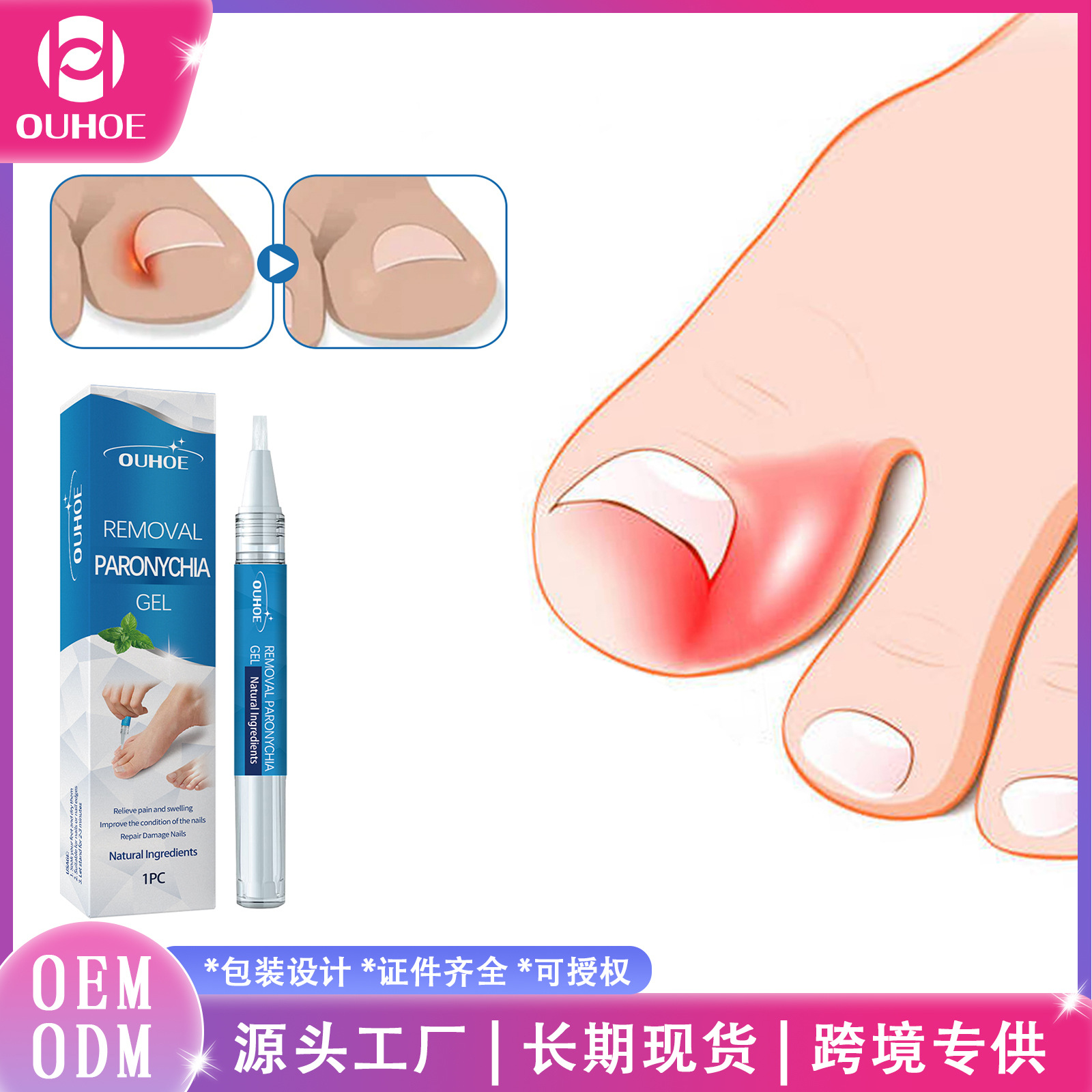 OUHOE Medical soft refreshing gel for nails