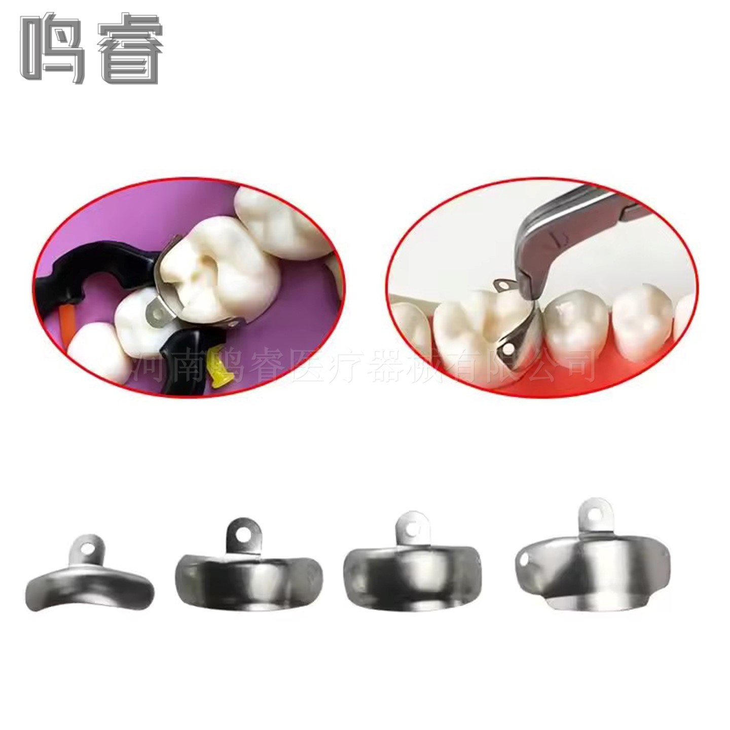 Dental Garrison, el mismo modelo de la pieza de moldeo de Douban dental con orificio M4, pieza de conformado de segmentos en forma de diente, paquete suplementario