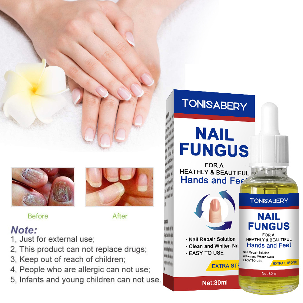 Cross-border nail essence care solution to remove onychomycosis 30 ml AliExpress Amazon