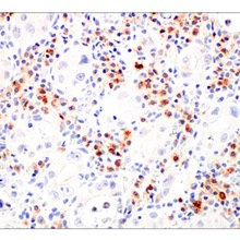 47778S CST LAMP3/CD208 ��E6E5U�� XP &reg; �Æο�¡���w 100ul