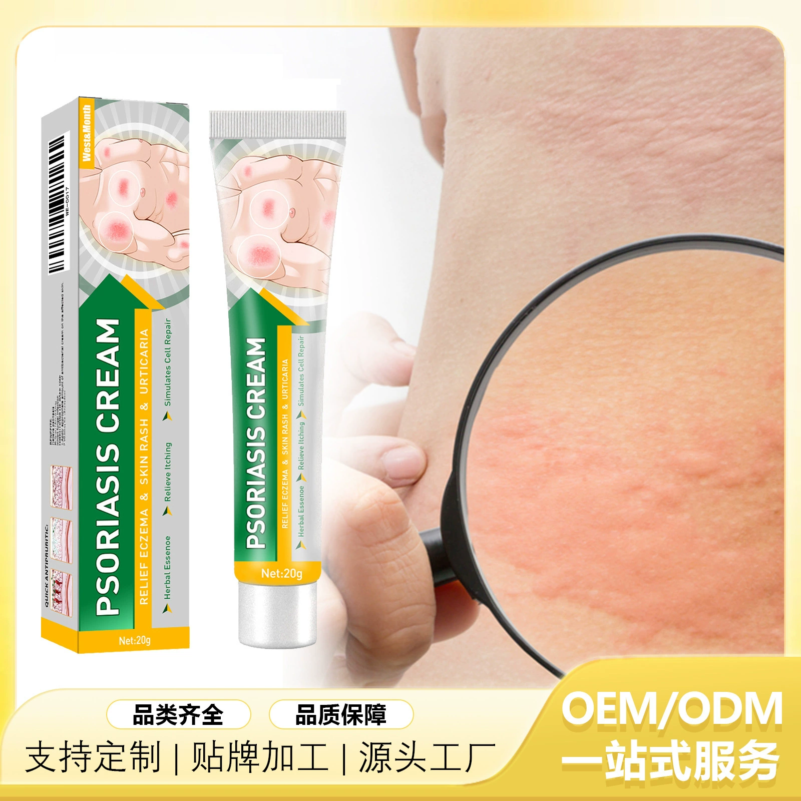 West & Month Противозудный крем для кожи и мох Экзуд комаров Укусы рук и ног