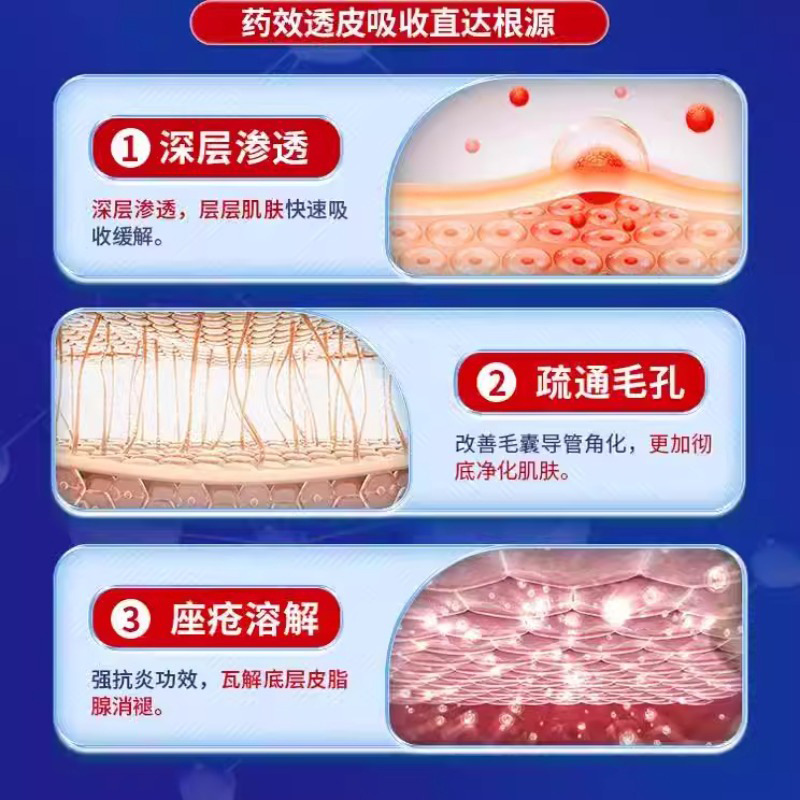 岩井昃弘重度暗疮玫瑰痤疮药膏祛痘脸上下巴起痘痘屏障修护专用膏|undefined