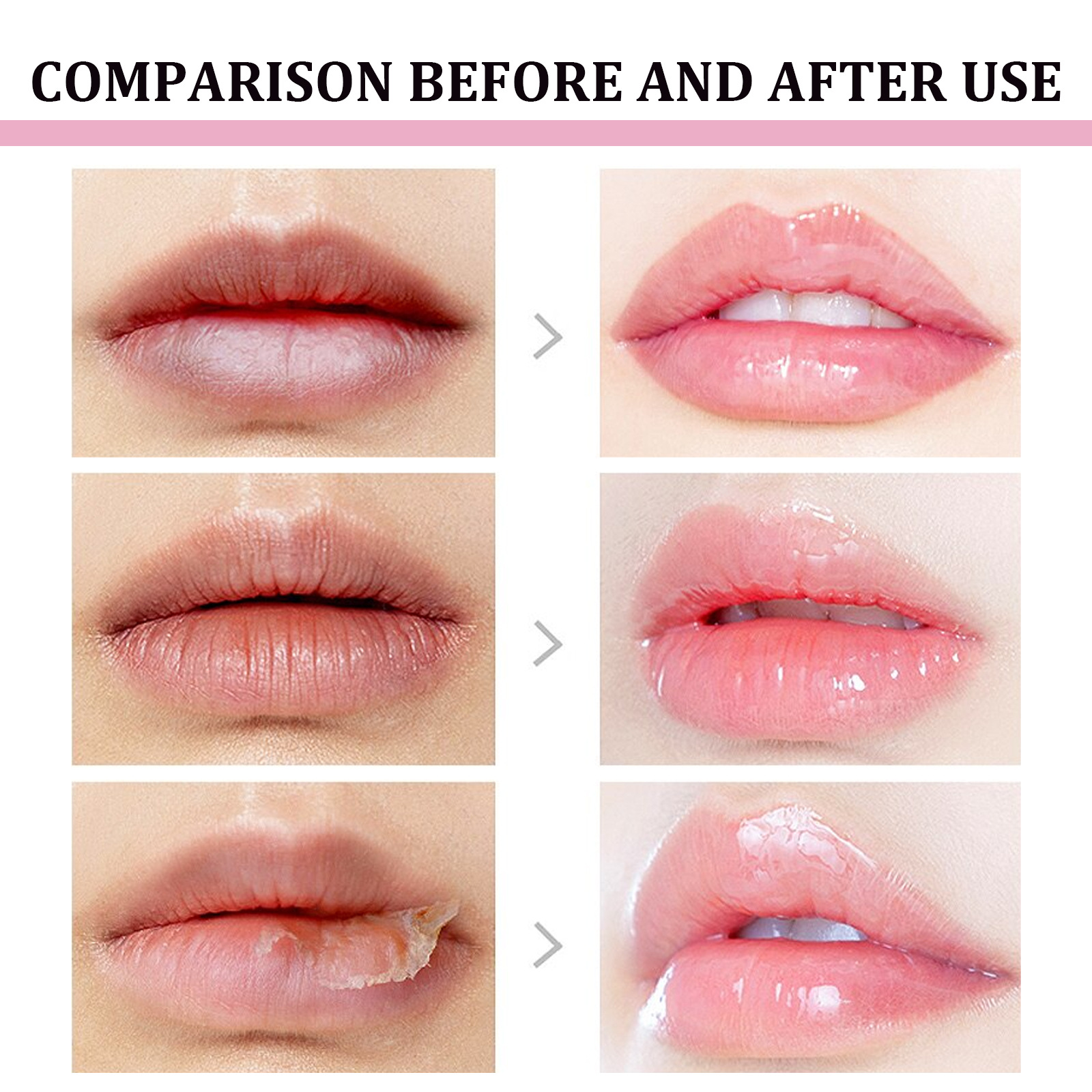 EELHOE Repair Repairs Dead Skin, Fade Lip Lines, Prevent Dry Cracks, and Moisturize Care Cream_voghion.com
