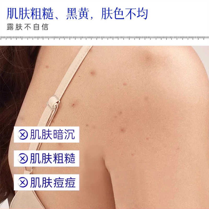 抖音爆款欧姿萃身体抛光水果酸祛痘身体喷雾淡化痘印闭口粉刺保湿|undefined