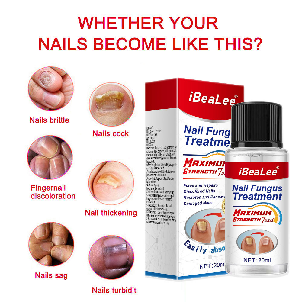 Líquido antibacteriano Crema de eliminación IBeaLee Poción especial espesante para uñas grises suaves_voghion.com