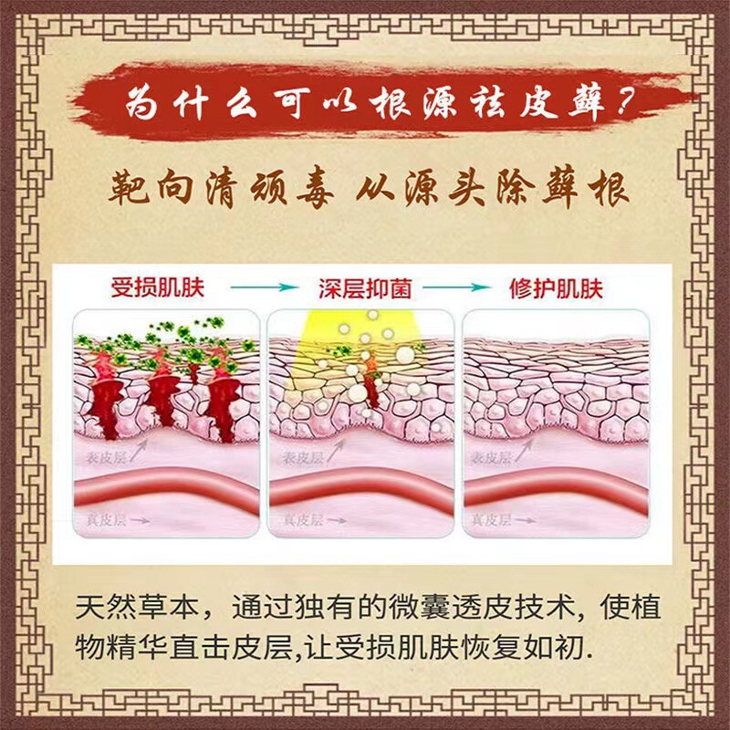 コケ軟膏殺菌皮膚かゆみ止め菌全身かゆみ外用百草かゆみ止めクリーム牛革コケ新鮮膏|undefined