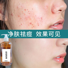 ����Ժ����AҺ������ӡ�����澏���wȥ�ഺ�����ͱ����ԭҺ