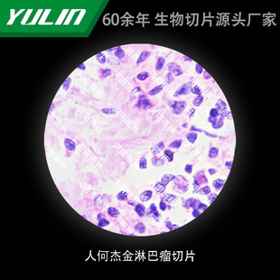 �˺΂ܽ��ܰ�ai��Ƭ��У�t�WԺУ�ýM������ʯϞ��Ƭ�˱��@΢�R