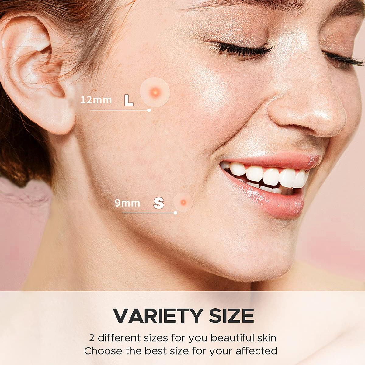 Cruz-frontera exclusiva invisible acné parche corrector estéril facial especial Reparación de primeros auxilios acné parche calmante acné cubierta en stock
