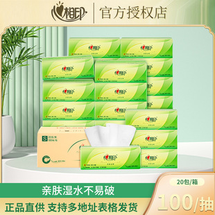 ��������ӡDT15100���Z�z��ϵ��100��20������鼈�������l�ͽ���