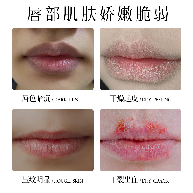 Dorythos Future Hydrating Repair Lip Mask Skinvape Hydrating Anti-Dryness Moisturizing Skin Care Brightening Lip Balm