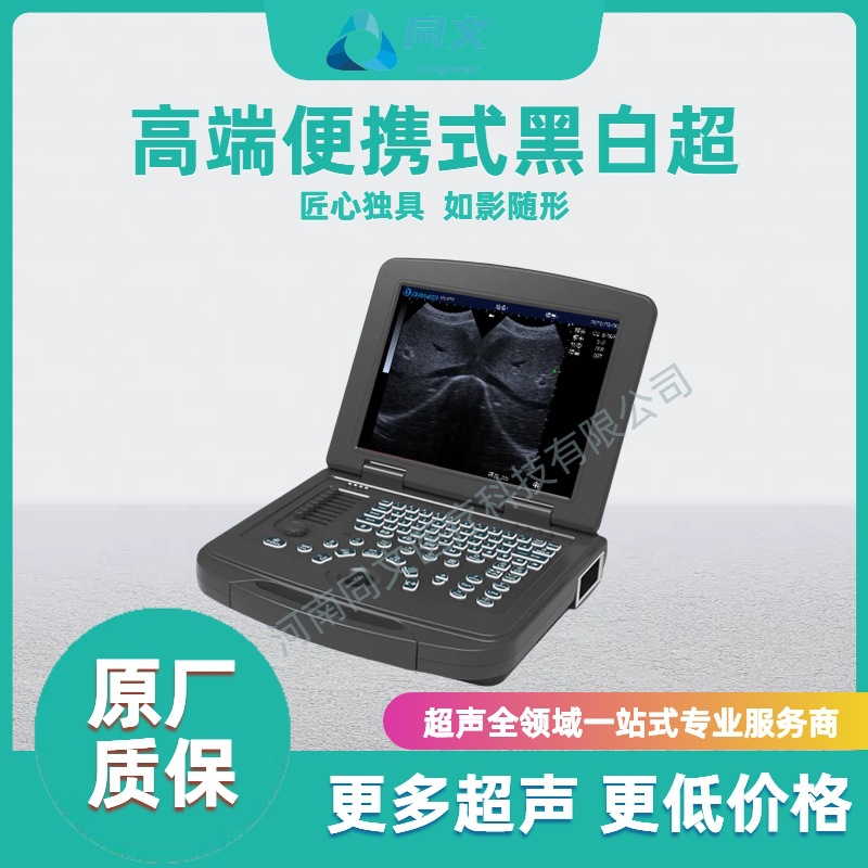 Ultrasonido portátil en blanco y negro Ultrasonido B portátil Ultrasonido B clínica de base Ultrasonido médico en blanco y negro
