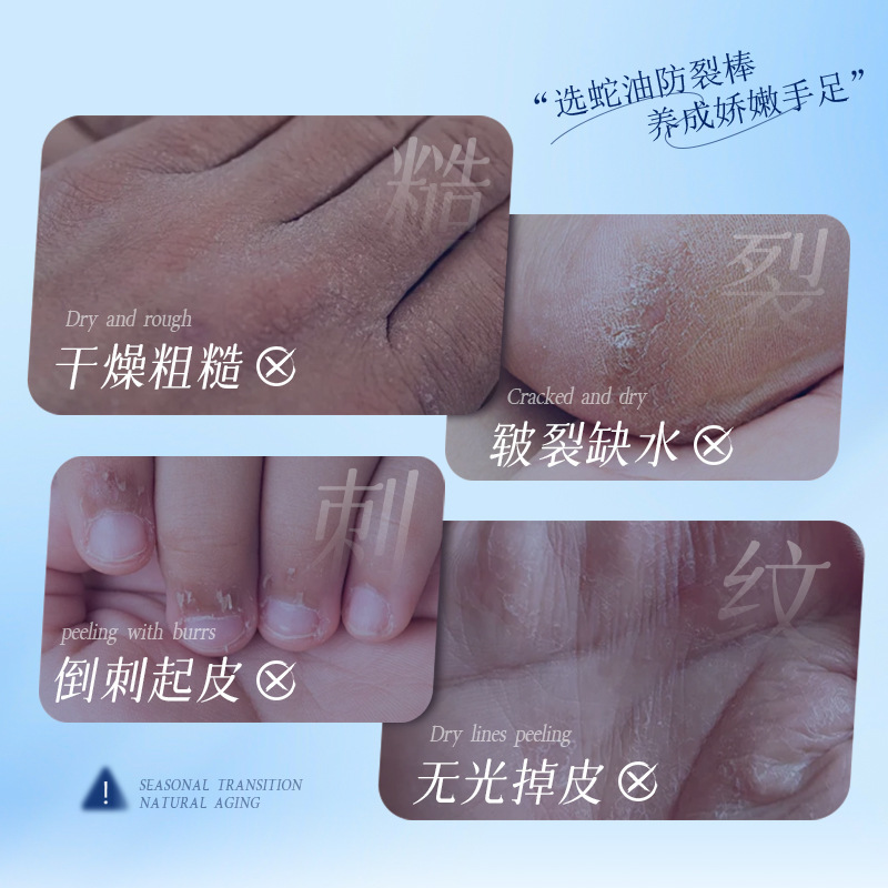 防裂棒皲裂膏脚后跟干裂护肤补水保湿滋润凡士林马油护手足霜批发|undefined