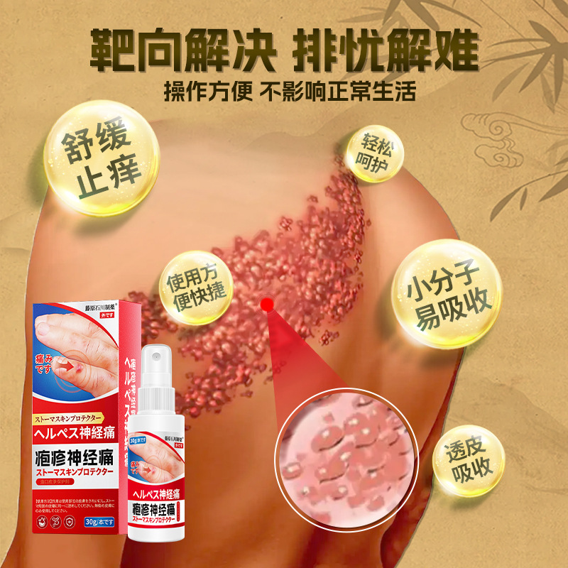 汗疹神経ケアスプレー、皮膚の小さな水疱、手足の皮膚のかゆみスプレー、OEM加工|undefined