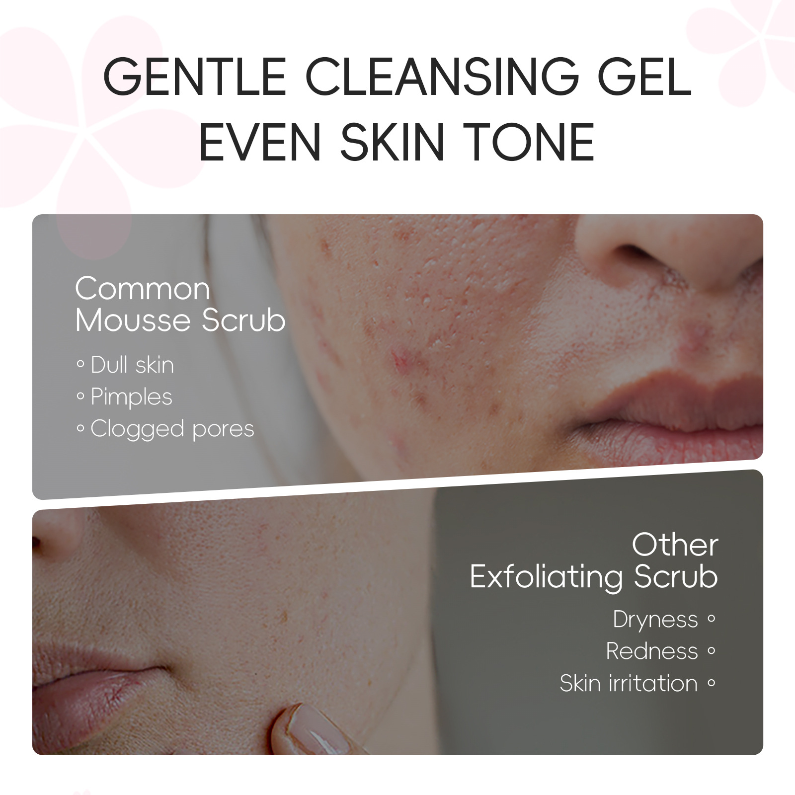 Women's Facial Pore Cleansing Skin Care Products O1CN012FV6aE22ycLTGcPcK !!2455077189 0 Cib