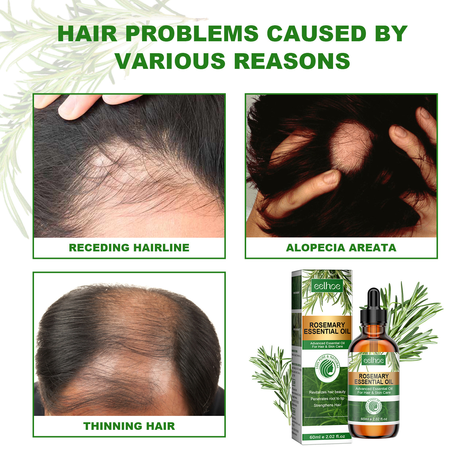 EELHOE Rosmarin ätherescht Ueleg reparéiert beschiedegt Hoer, stäerkt d'Hoer, mécht d'Hoer fest a glätt d'Hoer._voghion.com