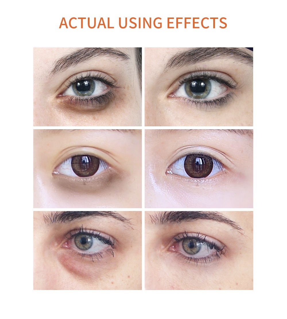 BREYLEE VC Eye Roll-on Serum