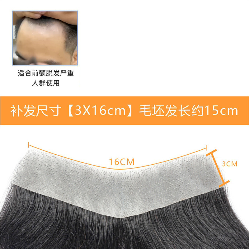 发际线假发贴假刘海假发片m形发际线贴男一片式前额补发自然真发|undefined