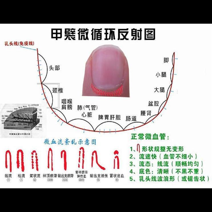 ハイビジョンマイクロサイクル検出器末梢血管観察器|undefined