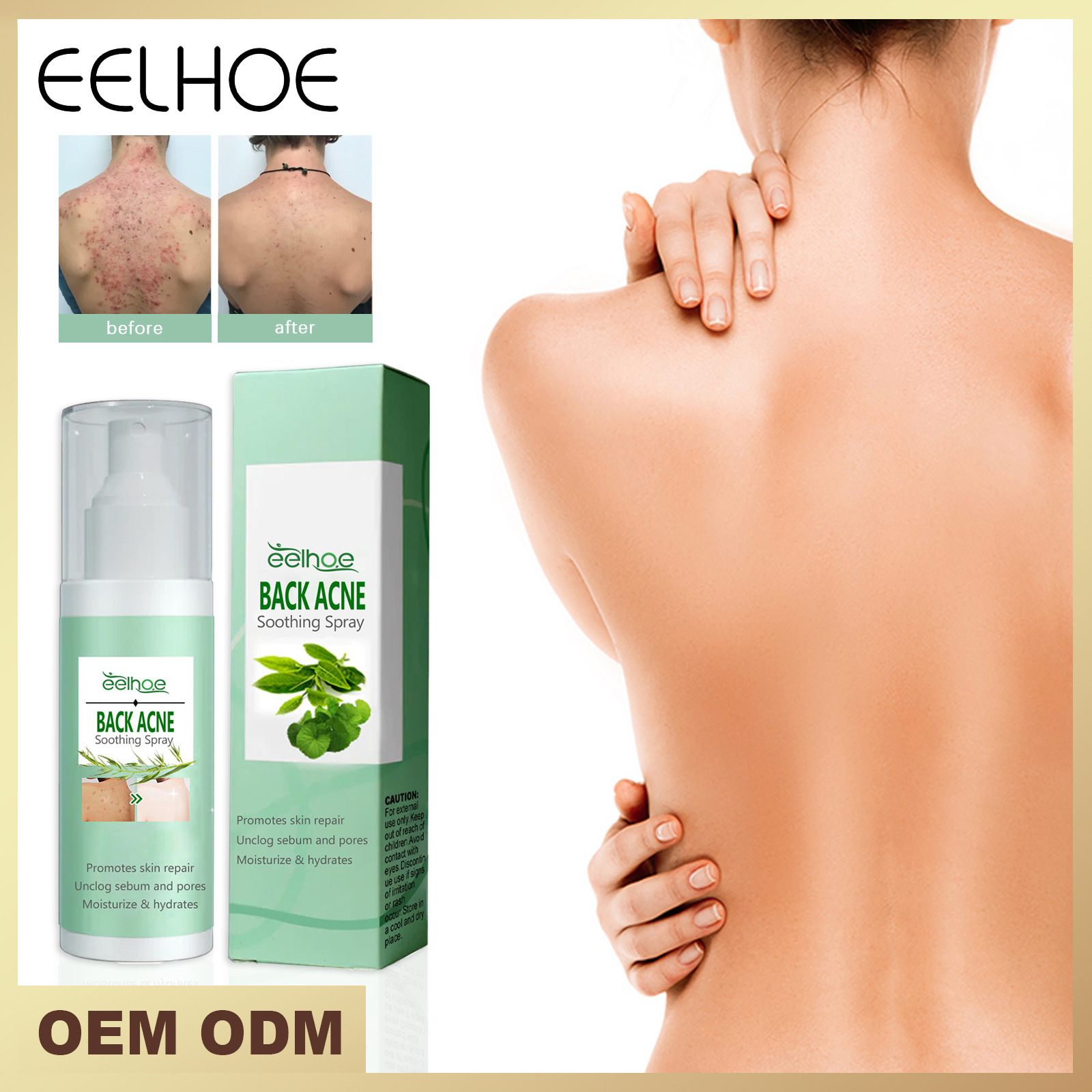 EELHOE repair reduces acne marks, cleans back, smoothes skin, and moisturizes spray_voghion.com