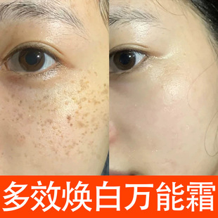 Whitening and Freckle Removal Cream, Removes Chloasma, Age Spots, Freckles, and Discolorations, Firming, Anti-Wrinkle, Moisturizing, Skin Care, Color Control, Multi-Effect Cream