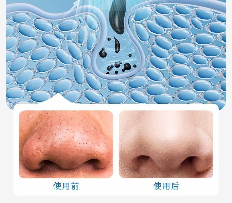 Best-selling blue light micro-bubble blackhead removal device deep cleansing facial cleanser pore shrinking oxygen infusion introduction cross-border