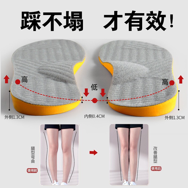 Xo-Shaped Calf Valgus Correction Insoles, Arch Support Insoles, Corrective Insoles for Leg Shape Correction, Straight Leg, Flat Foot Orthotics