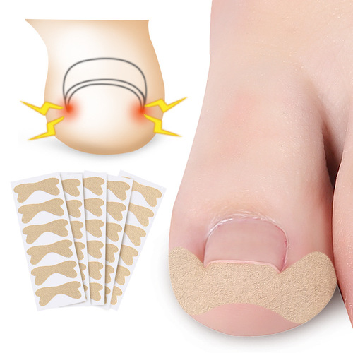 Glue-free nail correction patch to correct ingrown toes, inline correction of curly nails and toe patch