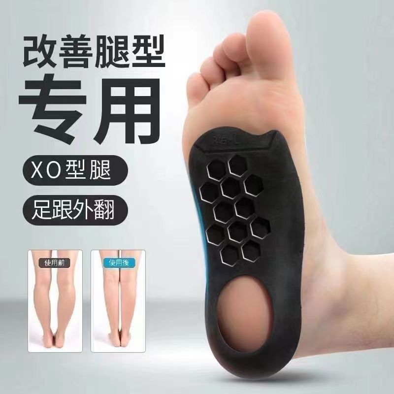Xo-Shaped Leg Flat Foot Correction Insole Foot Valgus Calf Valgus Correction Leg Shape Artifact Straight Leg Foot Half Palm Invisible