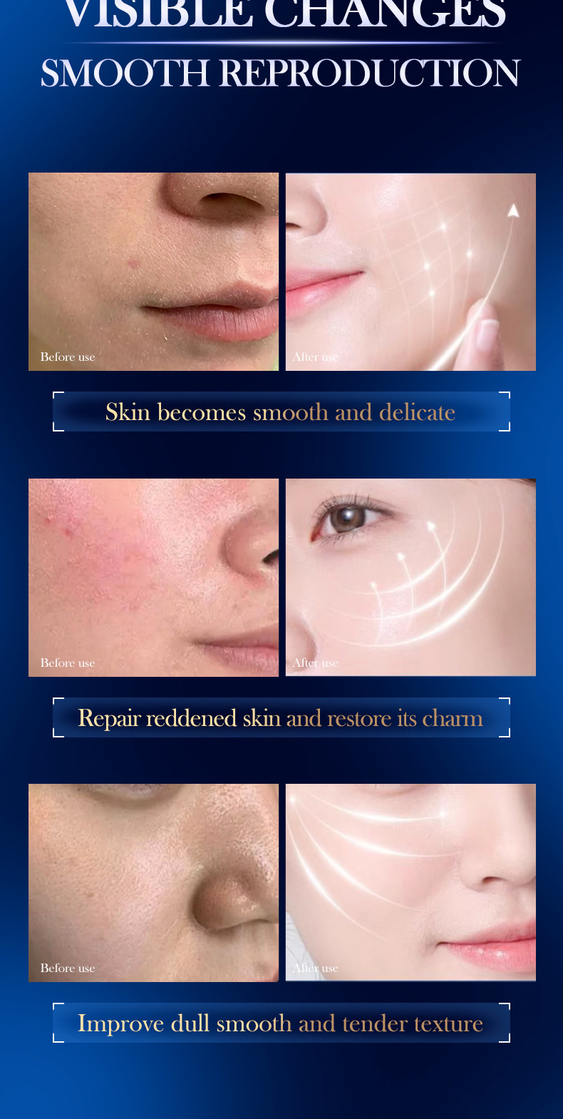 SADOER All Hyaluronic Acid B5 Moisturizing Repairing Sleep Skin Rejuvenating and Applying facial mask_voghion.com