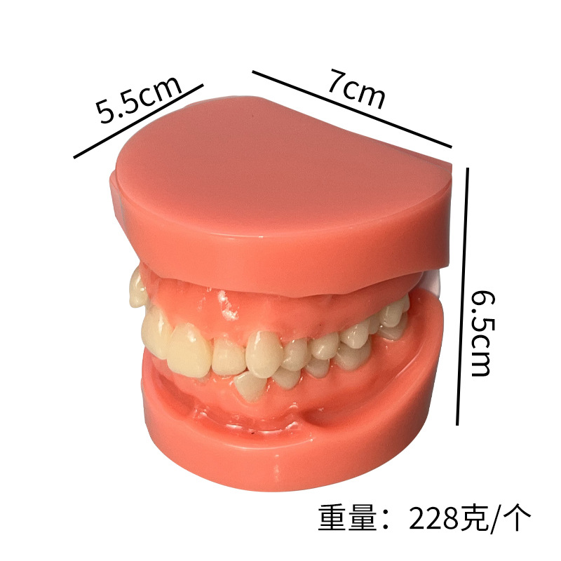 Modelo dental, modelo de corrección de demostración de mandíbula incorrecta, práctica de dentista, modelo de brackets pegajosos, molde de enseñanza de corrección