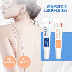Zhenxiu Vitamin A Acid Cream + Vitamin E Urea Cream for Acne, Dry Skin, Melasma, and Chicken Skin