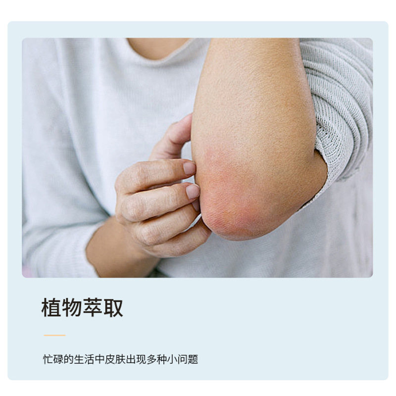 中正製薬のYiganjierjing軟膏は、家庭用の大人と子供用のハーブ皮膚かゆみ止め軟膏で、外用軟膏として使用できます。|undefined