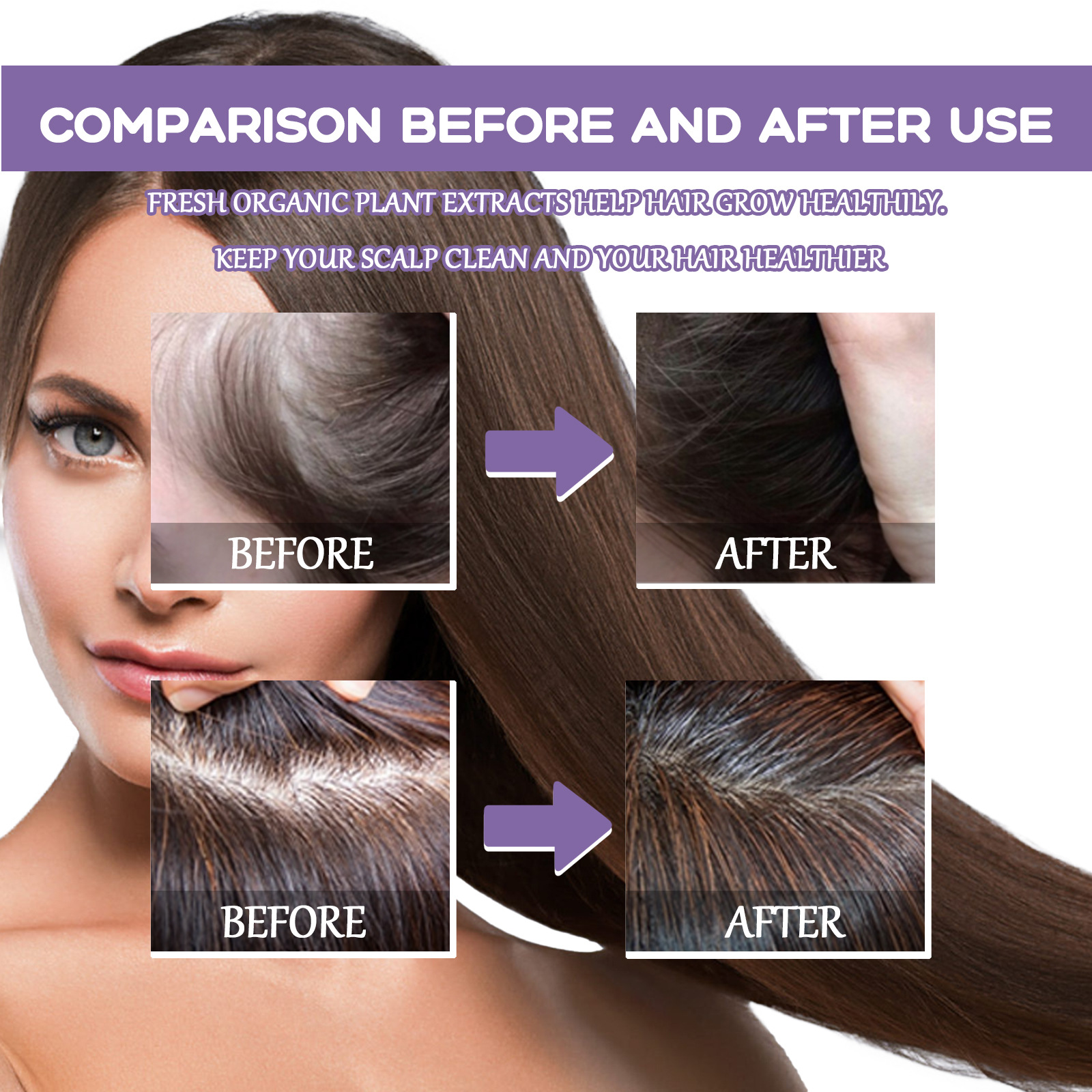 Googeer Hair Follicle Dense Hair Drops