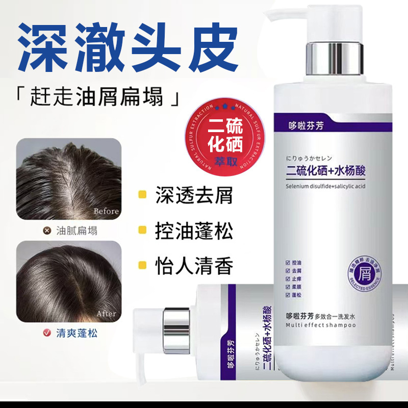 二硫化セレンシャンプー、オイルコントロール、さわやかでふわふわ、ふけ防止、かゆみ止め、サリチル酸シャンプー、男性用と女性用の香りが長持ち|undefined