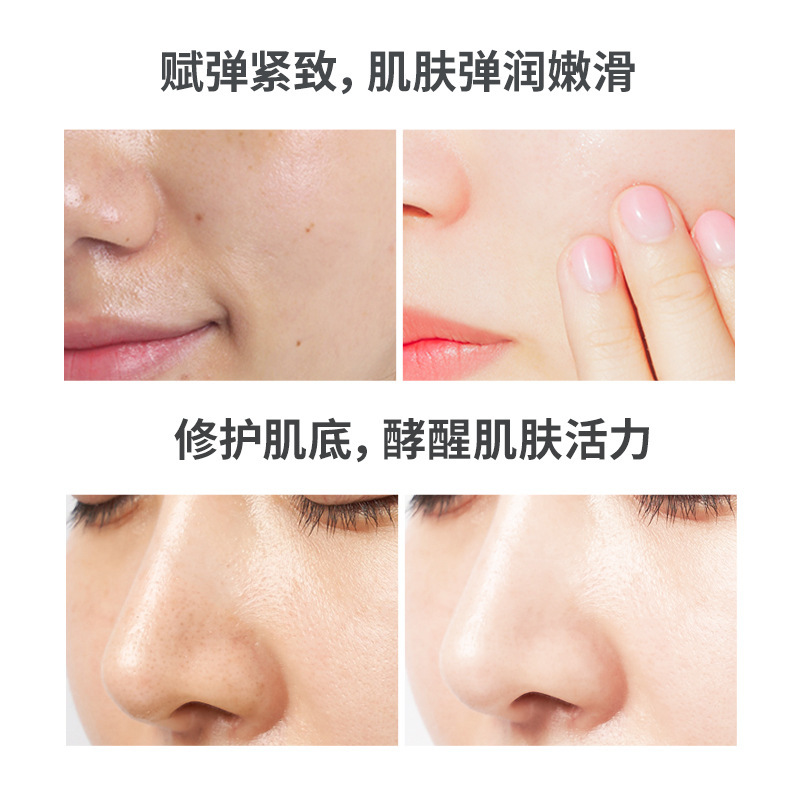 韩瑟二裂酵母透润护肤六件套 补水保湿滋润嫩滑清爽嫩肤护肤套盒|undefined