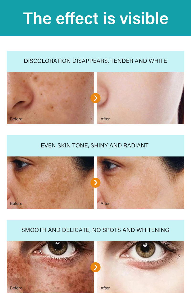 去黑斑色素霜-详情_08.jpg