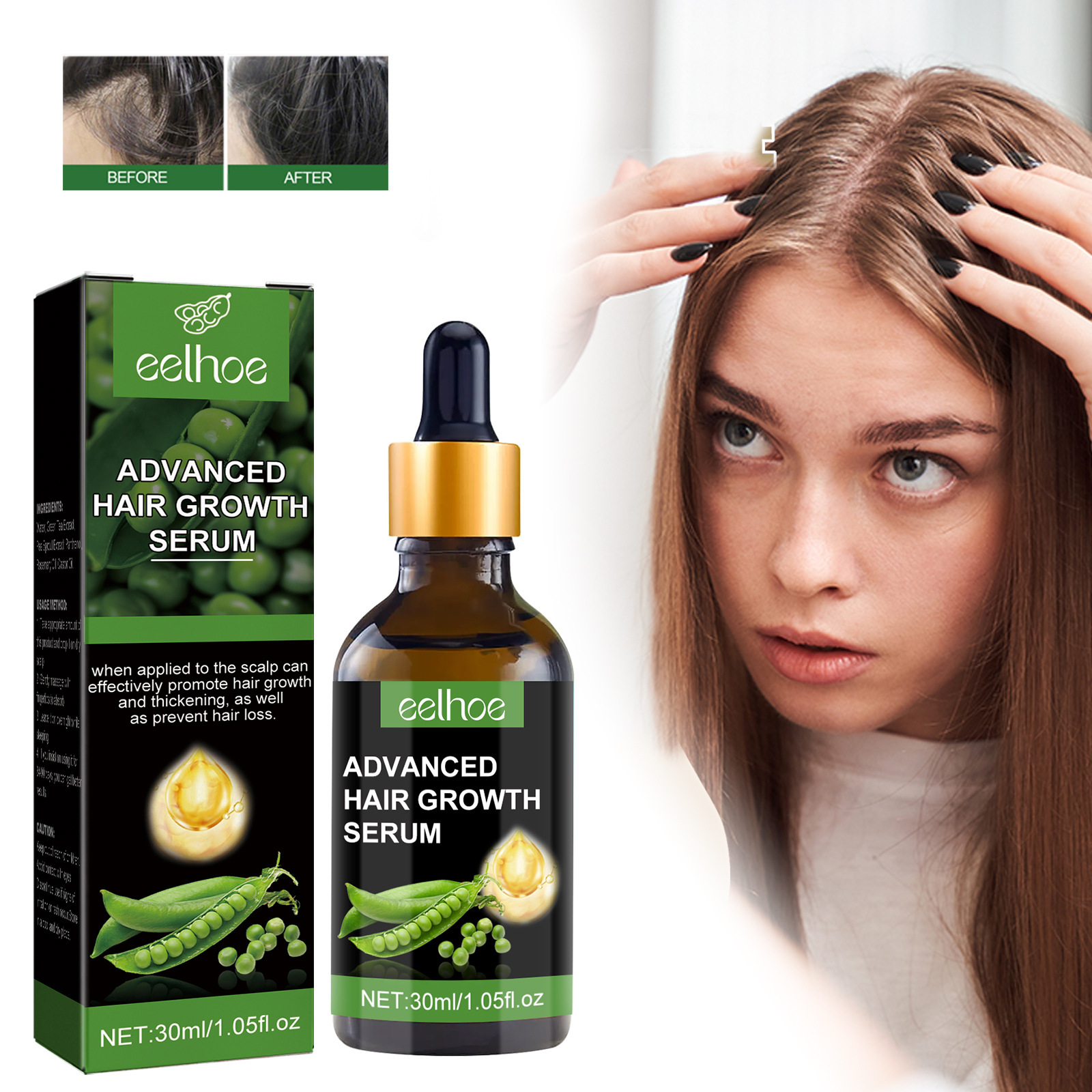 EELHOE Hair Essence Återfuktar hårrötterna, ger näring åt hårbotten, vårdar starkt hår, förhindrar håravfall och gör håret tjockare._voghion.com