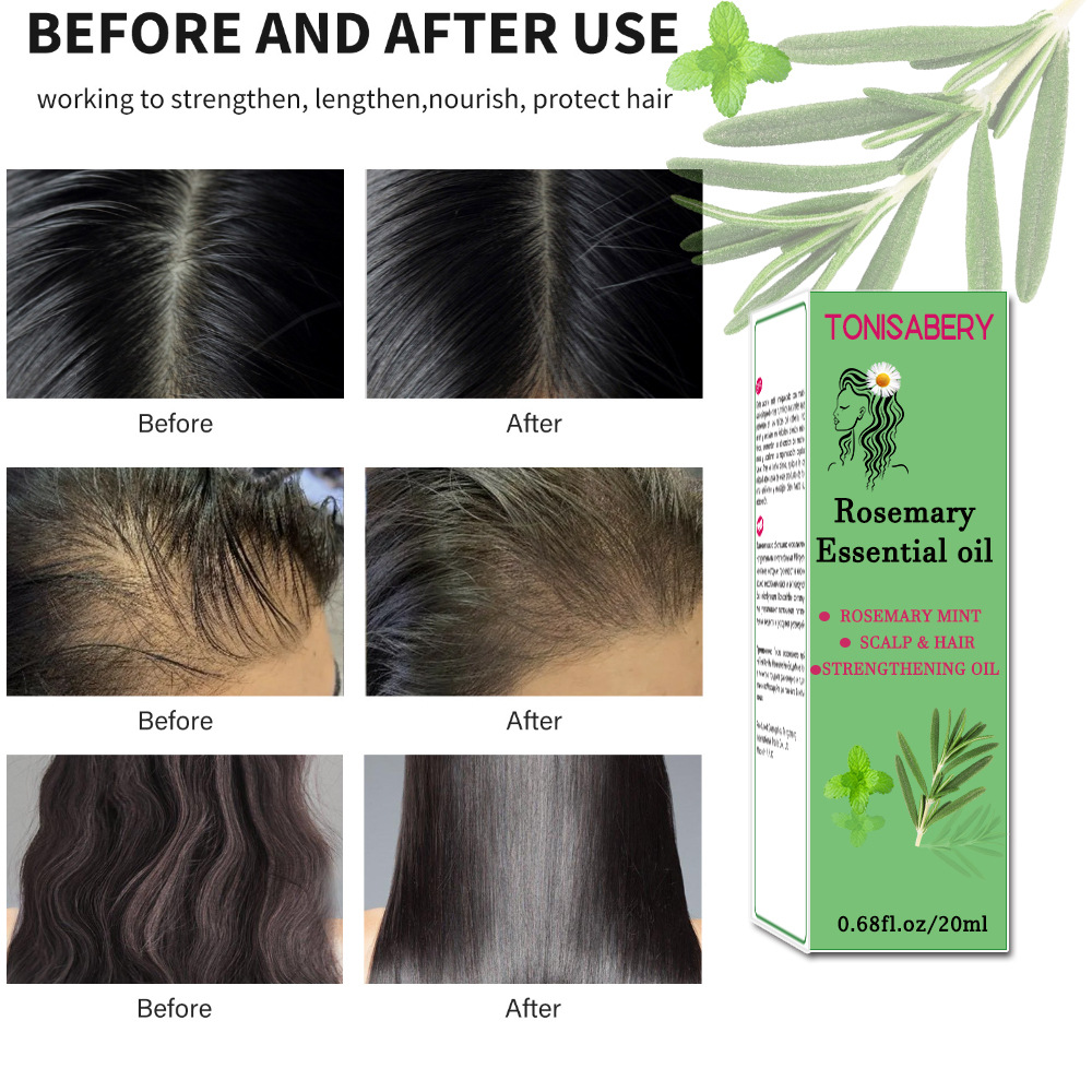 Testa di menta al rosmarino 20 ml Olio essenziale per la cura dei capelli riparatrice della pelle secca e danneggiata_voghion.com