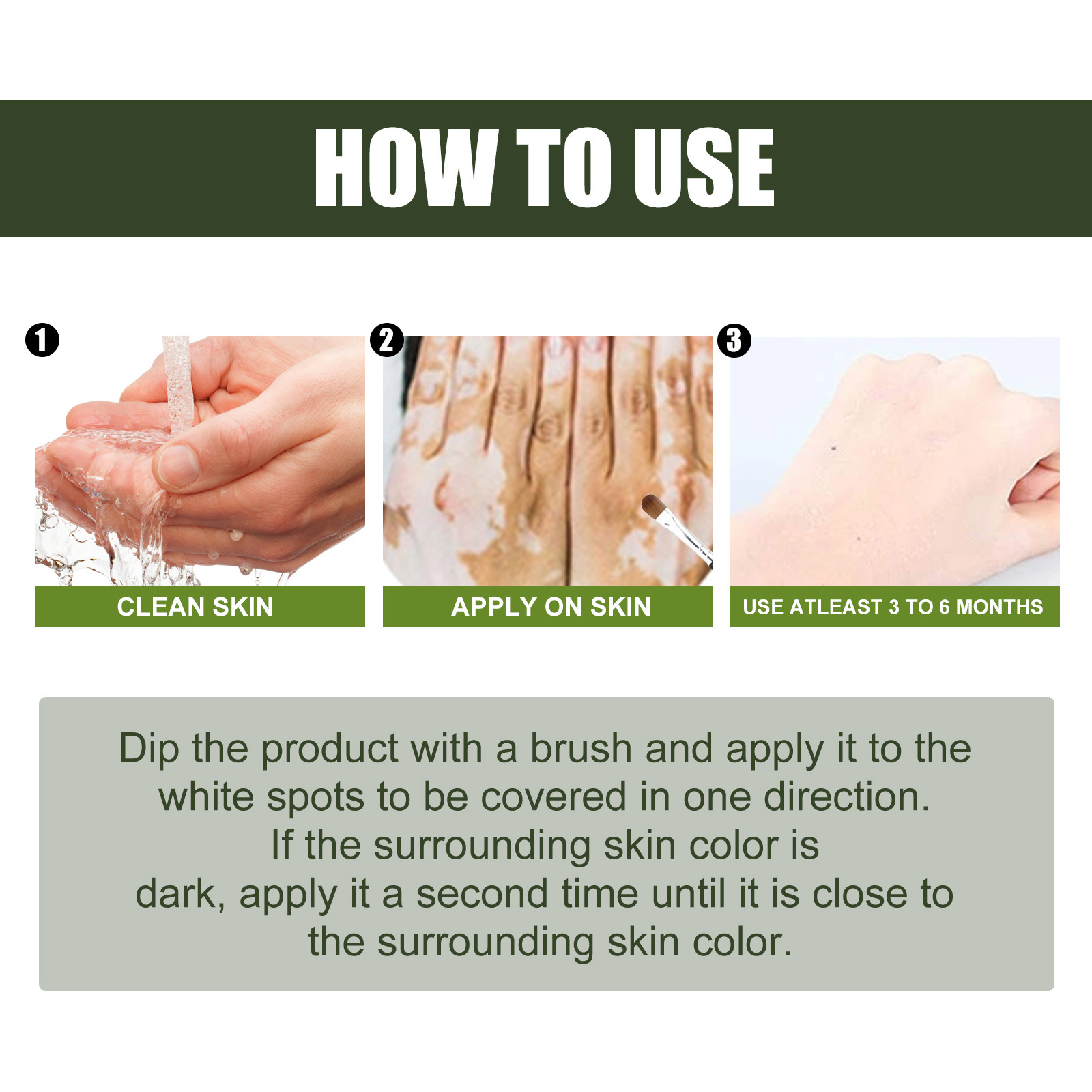 EELHOE Entferner Haut Leukoplakie Schweißfleckennetz Außenpflege Psoralen Essenz_voghion.com