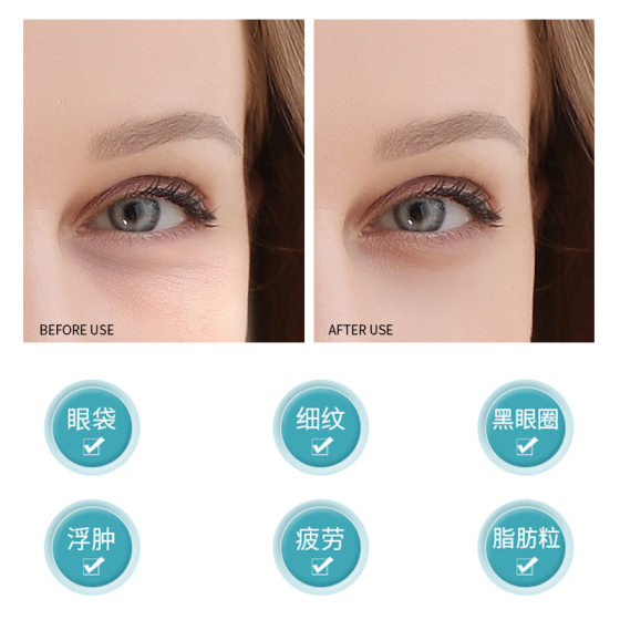 Hot compress eye beauty instrument household beauty instrument miniature portable lifting and tightening eye fine beauty eye cream introduction instrument
