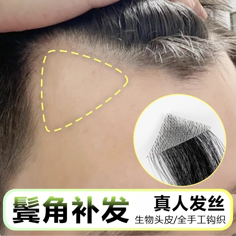 Hairline Stickers for Men, Sideburns, Men's Forehead Hair Replacement, Real Hair Invisible M-Shaped Forehead Hair Wigs, Bangs Hairline Stickers for Men, Sideburns, Men's Forehead Hair Replacement, Real Hair Invisible M-Shaped Forehead Hair Wigs, Bangs